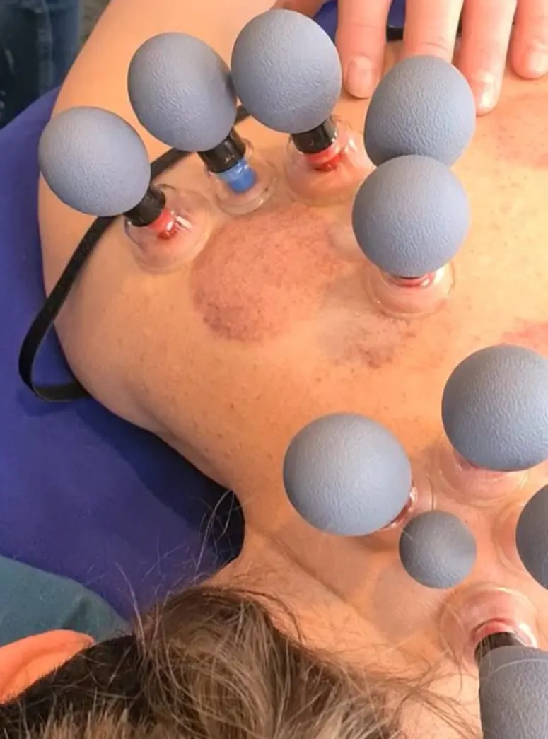 magneet cups op rug client Massagepraktijk ALT